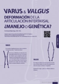 Imagen Revista Varus & Valgus, Deformación de la articulación intertarsal ¿manejo o genética?