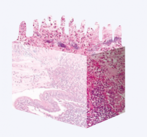 enteritis focal necrosante ponedoras