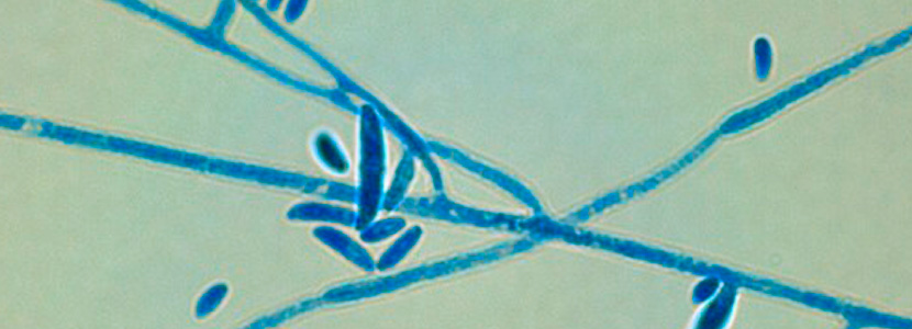 Micotoxinas emergentes en la industria avicola