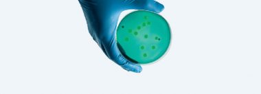 Imagen Revista GALLIBACTERIUM ANATIS, ¿un patógeno emergente en avicultura?