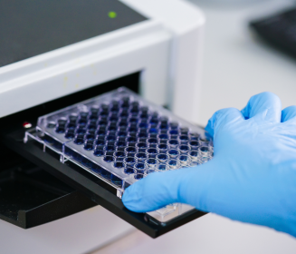 Imagen Revista Using baselines for ELISA serology