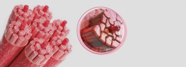 Imagen Revista Current problems of the quality of meat in the poultry industry
