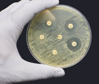 Imagen Revista Monitoring antibiotic resistance in Salmonella Spp.