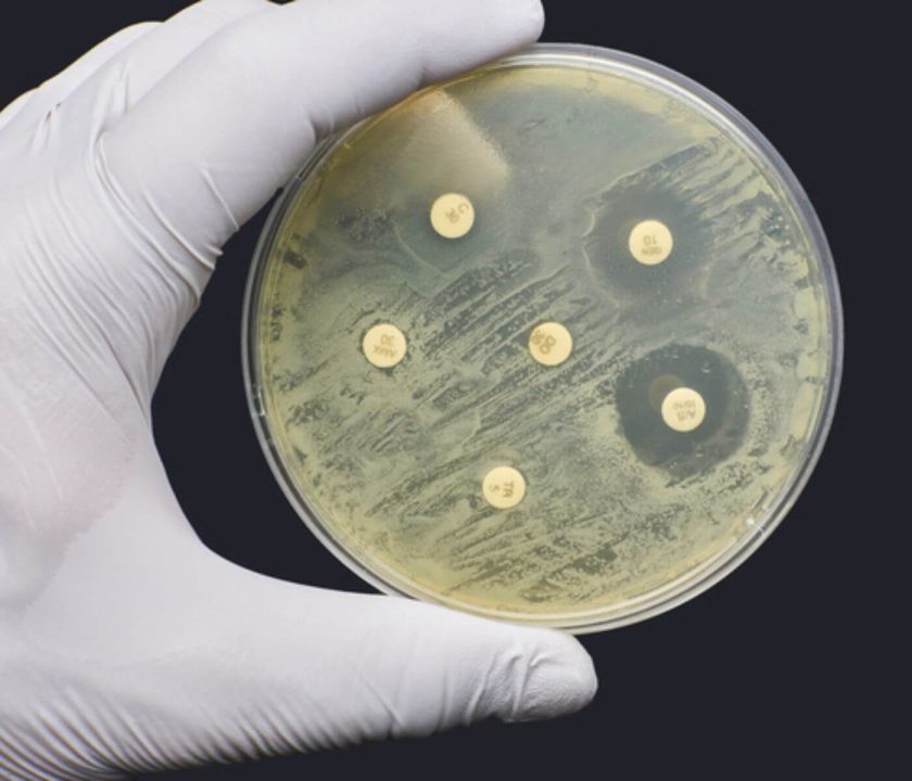 monitoring salmonella antibiotic resistance