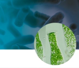 Biofilm, the survival strategy of microorganisms