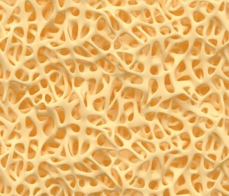 Possible causes of keel bone fractures (KBF) on laying hens