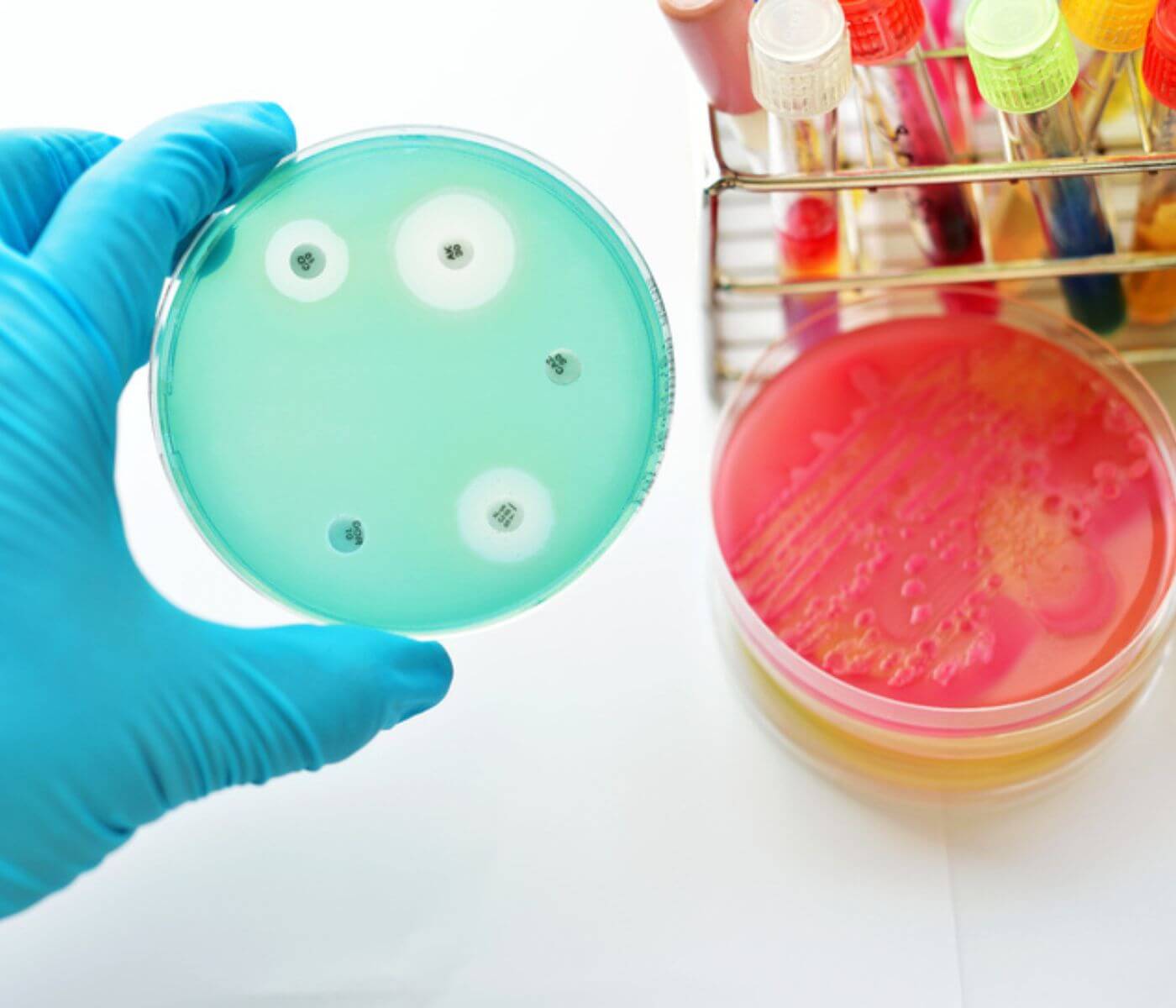 Bacteria resistant to highly used antibiotics still frequent in humans...