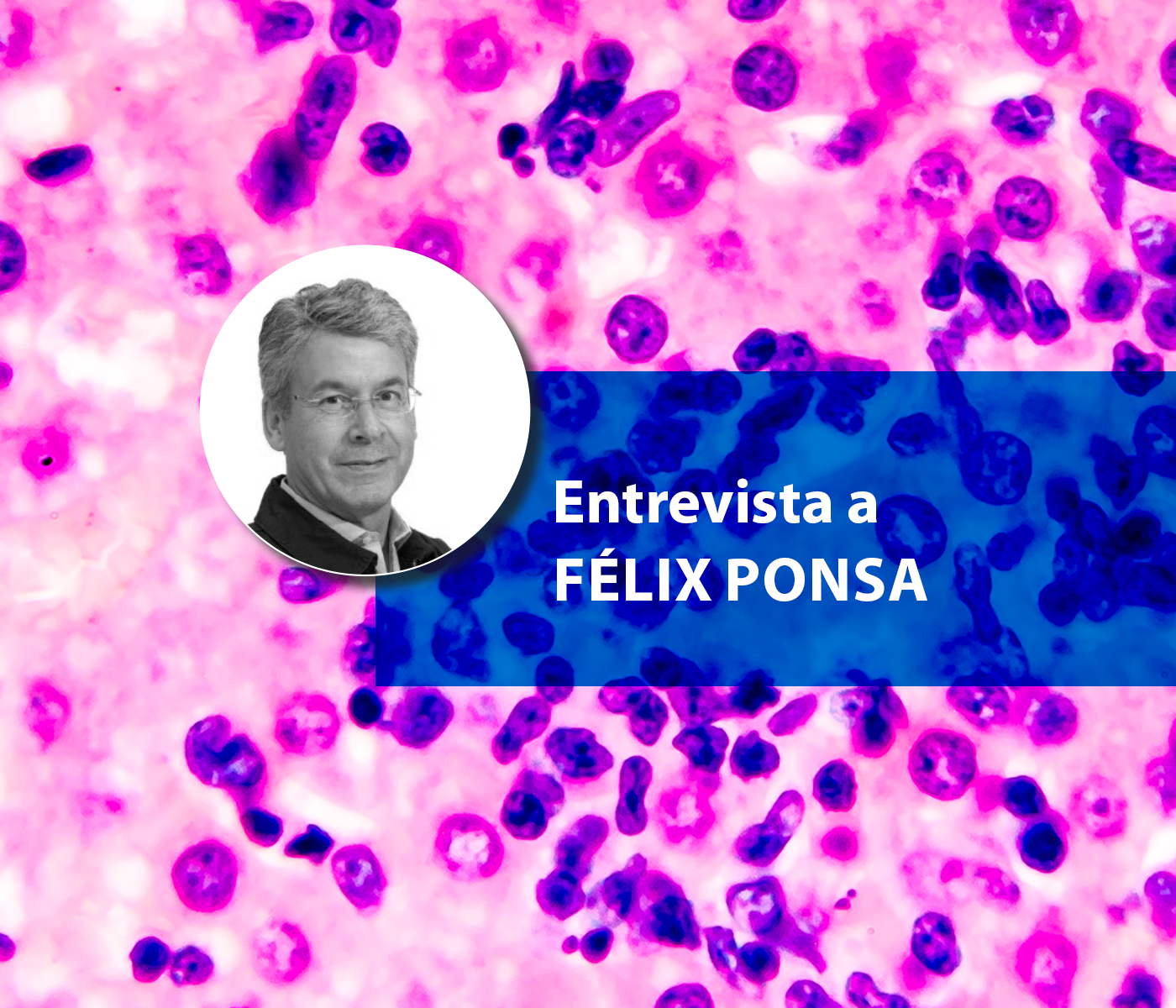 Actualización de la Coccidiosis. Entrevista con Felix Ponsa