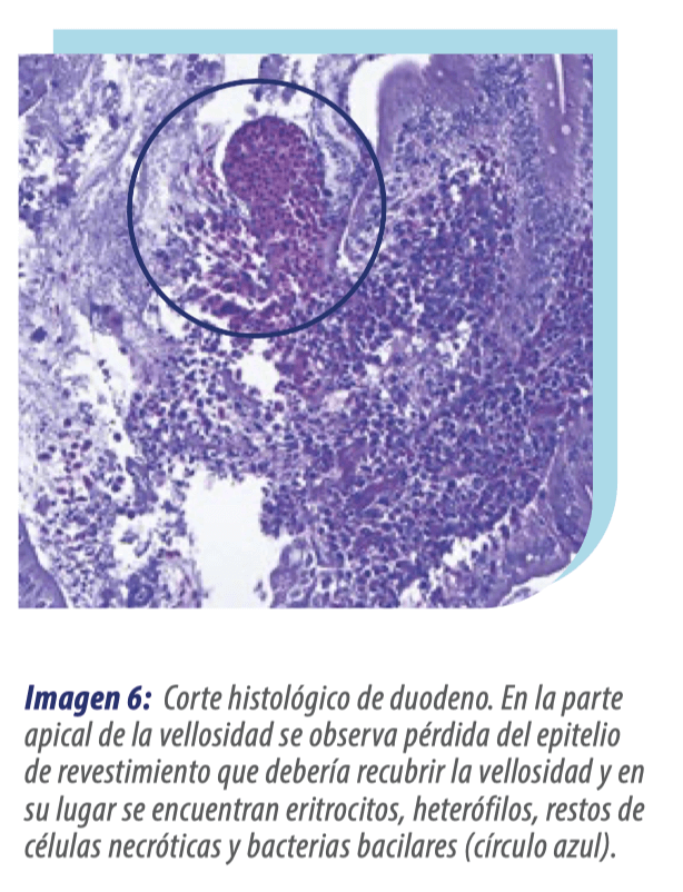 Aspergilosis sistémica & Duodenitis focal necrosante: Caso clínico