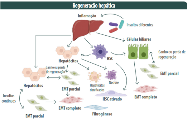 Figura 2. Xue, Wu, Liu (2013). Hepatic regeneration and the epithelial to mesenchymal transition (Regeneração hepática e transição epitelial para mesenquimal). World J Gastroenterol 19(9): 1380-1386.. DOI: https://dx.doi.org/10.3748/wjg.v19.i9.1380. Created with BioRender.com.