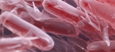 E. coli