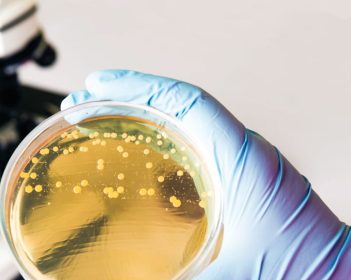 E. coli