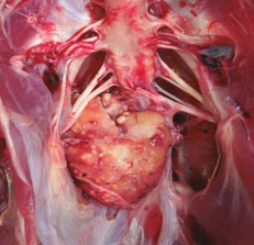  Marek's disease