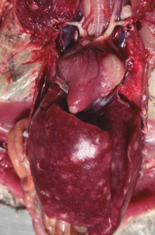 Leucose Linfoide