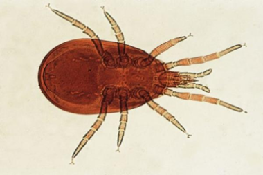Red Mite 