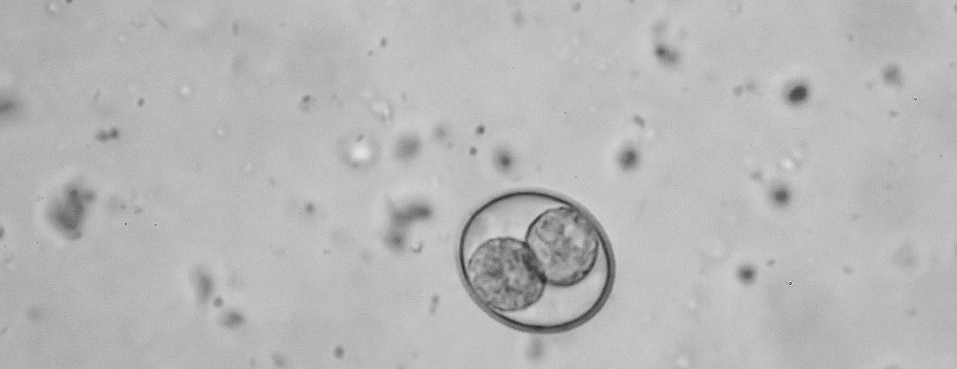 coccidiosis