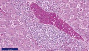 Lymphoid Leukosis.