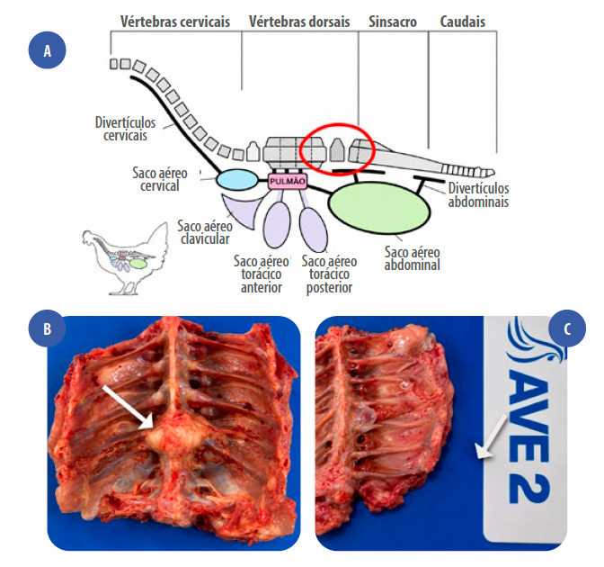 Figura 4. (a) Esquema de coluna vertebral de Gallus gallus apresentando vértebras pneumáticas e local indicado para remoção em autópsia(círculo vermelho). Fonte: adaptado de WEDEL, 2008. (b) Coluna vertebral de frango de corte exibindo proliferação óssea irregular acentuada com deformidade da arquitetura normal das vértebras (seta branca) com isolamento de E. faecalis. Fonte: os autores. (c) Coluna vertebral de frango de corte exibindo proliferação óssea irregular discreta (seta branca) com isolamento de E. faecalis. Fonte: os autores.